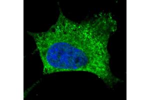 Fluorescent confocal image of SY5Y cells stained with NGFR antibody SY5Y cells were fixed with 4 % PFA (20 min), permeabilized with Triton X-100 (0. (NGFR antibody)