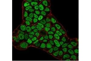 Immunofluorescence staining of PFA-fixed MCF-7 cells with MSH6 Mouse Monoclonal Antibody (MSH6/3086) followed by goat anti-mouse IgG-CF488 (green). (MSH6 antibody  (AA 374-540))