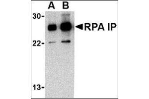 Western blot analysis of RPA Interacting Protein in Jurkat cell lysate with this product at (A) 0. (RPAIN antibody  (C-Term))