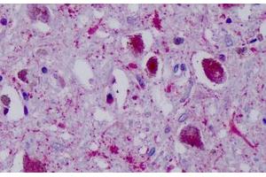 Anti-PPYR1 antibody IHC staining of human brain, substania nigra. (NPY4R antibody  (Cytoplasmic Domain))