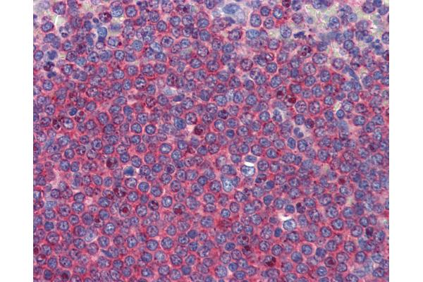 ALDH5A1 antibody  (C-Term)
