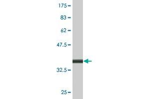 Western Blot detection against Immunogen (36. (LAMP2 antibody  (AA 30-127))