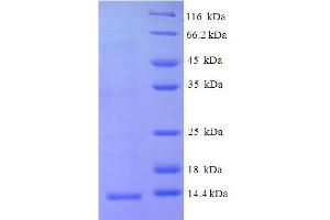 SDS-PAGE (SDS) image for C-X-C Motif Chemokine 10 (CXL10) (AA 22-98) protein (His tag) (ABIN5711539)