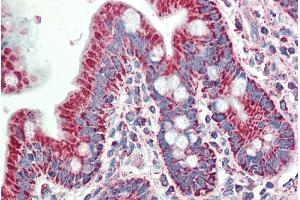 ABIN1590031 (5µg/ml) staining of paraffin embedded Human Small Intestine. (SLAMF8 antibody  (Internal Region))