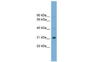 WB Suggested Anti-Gm5864 Antibody Titration:  0. (Gm5864 antibody  (Middle Region))