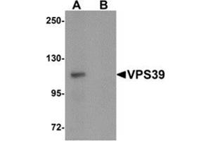 Western blot analysis of VPS39 in rat liver tissue lysate with VPS39 antibody at 0.
