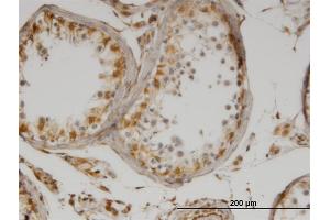 Immunoperoxidase of monoclonal antibody to IL13 on formalin-fixed paraffin-embedded human testis. (IL-13 antibody)