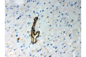 Immunohistochemistry (IHC) image for anti-BCL2-Antagonist/killer 1 (BAK1) (AA 22-211) antibody (ABIN4950296)