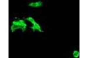 Image no. 2 for anti-Chromosome 2 Open Reading Frame 62 (C2orf62) antibody (ABIN1497053) (C2orf62 antibody)