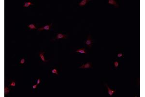 ABIN6266520 staining HeLa  cells by IF/ICC. (Cullin 1 antibody)