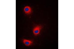 Immunofluorescent analysis of TRP2 staining in A375 cells. (DCT antibody  (Center))