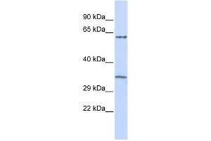 WB Suggested Anti-TRIM8 Antibody Titration:  0. (TRIM8 antibody  (Middle Region))