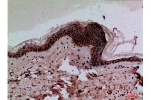 Immunohistochemistry (IHC) analysis of paraffin-embedded Human Skin, antibody was diluted at 1:100. (CEACAM1/5 antibody  (N-Term))