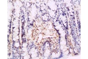 Formalin-fixed and paraffin embedded rat colon tissue labeled with Anti-P-selectin Polyclonal Antibody , Unconjugated at 1:200, followed by conjugation to the secondary antibody and DAB staining (P-Selectin antibody  (AA 701-768))