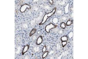 Immunohistochemical staining of human kidney with GRAMD1A polyclonal antibody  shows strong cytoplasmic positivity in a subset of tubules. (GRAMD1A antibody)