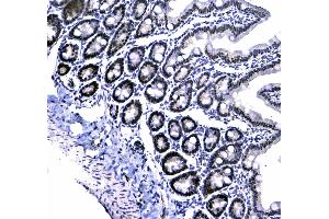 IHC analysis of HP1 gamma using anti-HP1 gamma antibody . (CBX3 antibody  (AA 2-183))