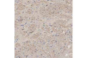 IHC analysis of SLC25A23 using anti-SLC25A23 antibody (ABIN7600165). (SLC25A23 antibody  (AA 16-189))