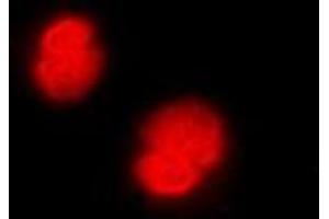 Immunofluorescent analysis of CaMK4 staining in Jurkat cells. (CAMK4 antibody)
