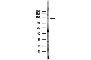 Western blot analysis of lysates from PC12 cells(LPS 4h treatment), using DAC Antibody at 1/1000 dilution.