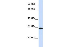 WB Suggested Anti-MTHFD2 Antibody Titration:  0.