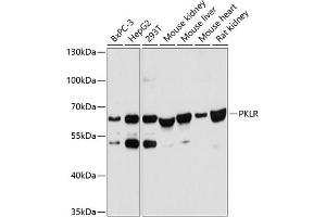 Western blot analysis of extracts of various cell lines, using PKLR antibody (ABIN6128469, ABIN6145710, ABIN6145712 and ABIN6215656) at 1:3000 dilution. (PKLR antibody  (AA 446-556))
