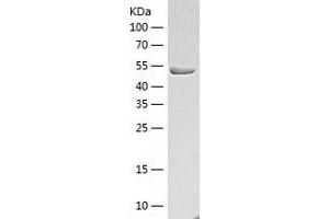 Western Blotting (WB) image for Hydroxyacyl-Coenzyme A Dehydrogenase/3-Ketoacyl-Coenzyme A Thiolase/enoyl-Coenzyme A Hydratase (Trifunctional Protein), alpha Subunit (HADHA) (AA 488-763) protein (His-IF2DI Tag) (ABIN7283276) (HADHA Protein (AA 488-763) (His-IF2DI Tag))