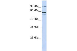 WB Suggested Anti-ABCE1 Antibody Titration:  0. (ABCE1 antibody  (C-Term))