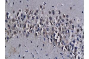 Immunohistochemistry (IHC) image for anti-Ionized Calcium-binding Adapter Molecule 1 (IBA1) (AA 51-147) antibody (ABIN685477)