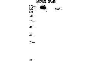 Western Blot (WB) analysis of Mouse Brain lysis using NOS3 antibody. (ENOS antibody  (Thr180, Tyr182))