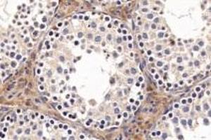 Immunohistochemistry analysis of paraffin-embedded mouse testis using ACE (ABIN7073050) at dilution of 1: 1000 (Angiotensin Converting Enzyme 1 antibody)