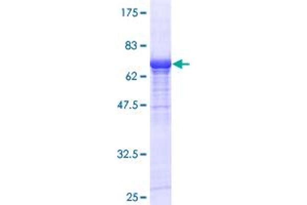 Villin 1 Protein (VIL1) (AA 1-421) (GST tag)