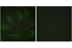 Immunofluorescence analysis of A549 cells, using CBL (Phospho-Tyr774) Antibody. (CBL antibody  (pTyr774))