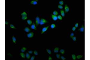 Immunofluorescence staining of Hela cells with ABIN7164629 at 1:100, counter-stained with DAPI. (USP9X antibody  (C-Term))