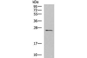 Western blot analysis of Human fetal brain tissue lysate using CLEC4D Polyclonal Antibody at dilution of 1:700 (CLEC4D antibody)