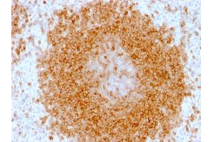 Immunohistochemistry (IHC) image for anti-CD27 Molecule (CD27) antibody (ABIN6941124)