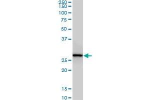 CNOT7 monoclonal antibody (M01), clone 2F6. (CNOT7 antibody  (AA 1-285))