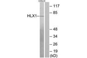 Western blot analysis of extracts from COLO205 cells, using HLX1 Antibody. (HLX antibody  (AA 321-370))
