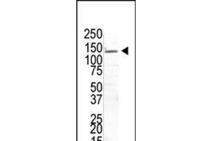 The anti-USP8 Pab (ABIN388890 and ABIN2839180) is used in Western blot to detect USP8 in transfected 293T cells. (USP8 antibody  (N-Term))