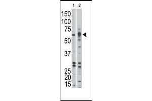 The anti-ACVR1B Pab (ABIN392232 and ABIN2841926) is used in Western blot to detect ACVR1B in Jurkat (1) and mouse kidney (2) tissue lysates. (Activin A Receptor Type IB/ALK-4 antibody  (AA 134-164))