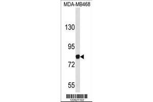 Western blot analysis of EVI5 Antibody in MDA-MB468 cell line lysates (35ug/lane) (EVI5 antibody  (N-Term))