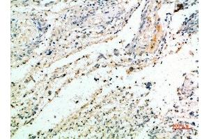 Immunohistochemical analysis of paraffin-embedded human-brain, antibody was diluted at 1:200 (Versican antibody  (AA 2530-2580))