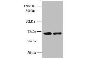 Western blot All lanes: RWDD2A antibody at 0.