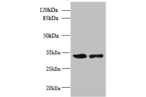 RWDD2A Antikörper  (AA 1-292)