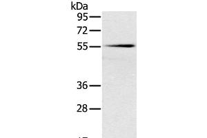 Western Blot analysis of Mouse pancreas tissue using SLC16A10 Polyclonal Antibody at dilution of 1:200 (SLC16A10 antibody)
