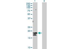 Western Blot analysis of ST6GAL1 expression in transfected 293T cell line by ST6GAL1 MaxPab polyclonal antibody. (ST6GAL1 antibody  (AA 1-175))