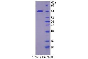 Image no. 1 for Protease, Serine, 23 (PRSS23) (AA 20-383) protein (His tag) (ABIN1878793) (PRSS23 Protein (AA 20-383) (His tag))