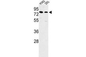 Western Blotting (WB) image for anti-Solute Carrier Family 3 Member 1 (SLC3A1) antibody (ABIN3003916) (SLC3A1 antibody)