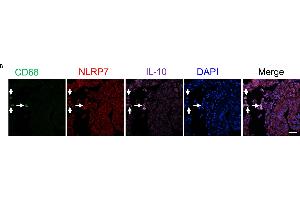 NLRP7 is predominantly expressed in decidual M2 macrophages (CD68+/IL-10+) in the human endometrium of the pregnant uterus. (IL-10 antibody  (AA 101-178))