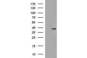 Image no. 1 for anti-Fatty Acid 2-Hydroxylase (FA2H) antibody (ABIN1500828)