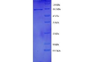 DnaJ (Hsp40) Homolog, Subfamily B, Member 1 (DNAJB1) (AA 1-340), (full length) protein (GST tag)